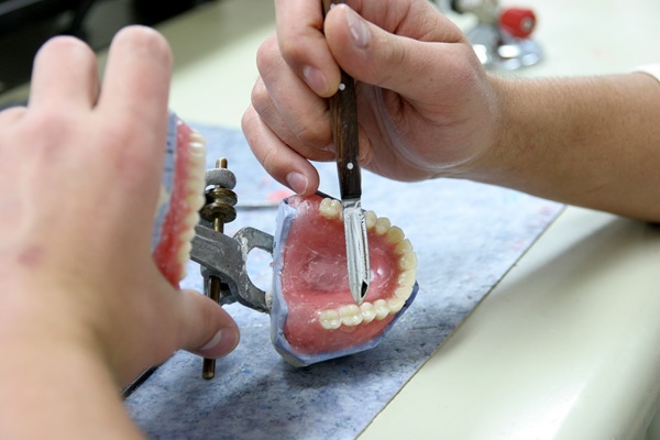 What To Know Before Full Mouth Reconstruction Procedures