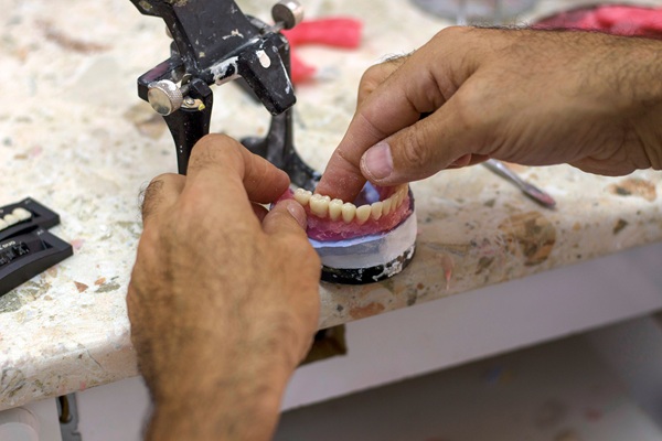 How Full Mouth Reconstruction Combines Function And Aesthetics